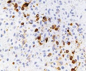 IDH1-R132H [IHC132]