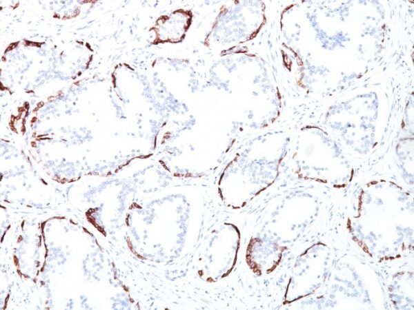 Cytokeratin HMW [34BE12]