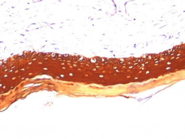 Cytokeratin LMW [KRTL/1077]