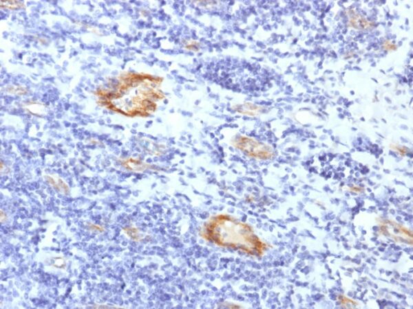 Factor VIII RA/Von Willebrand Factor Recombinant [VWF/1859R]