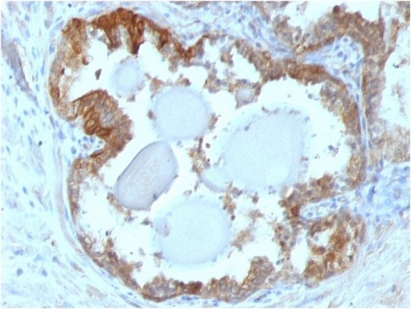 Heat Shock Protein (HSP27) [G3.1]