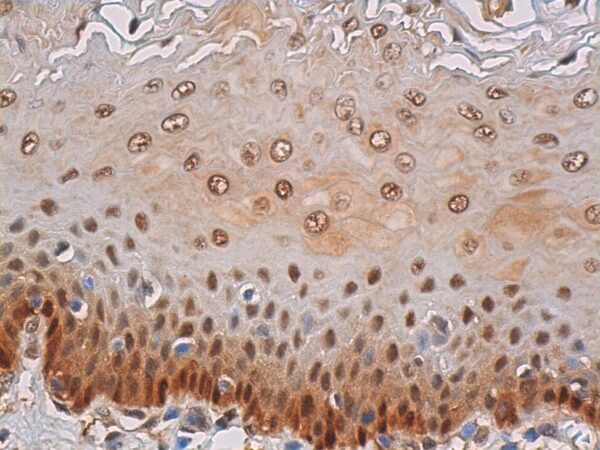 Heat Shock Protein (HSP70)/HSC70 [W27]