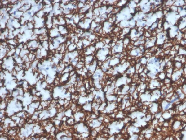 Myelin Basic Protein (MBP) [MD139R]