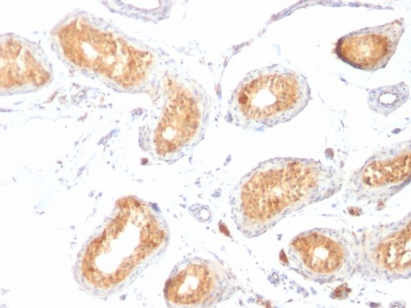 Melanoma gp100/PMEL17/SILV [HMB45]