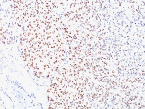 MiTF (Microphthalmia Transcription Factor) [C5/D5]