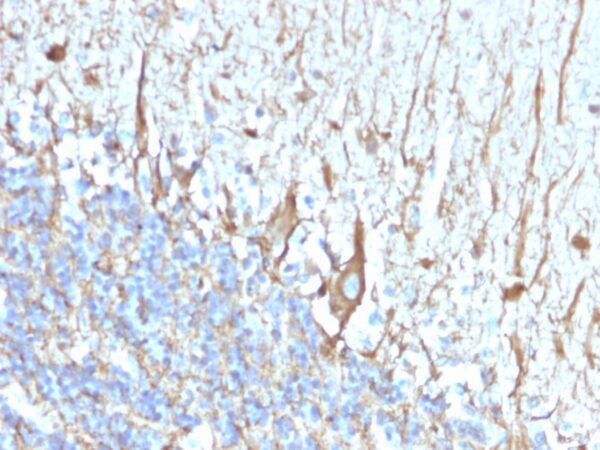 Neurofilament Heavy+Light Chain (NF-H+L) [2F11]