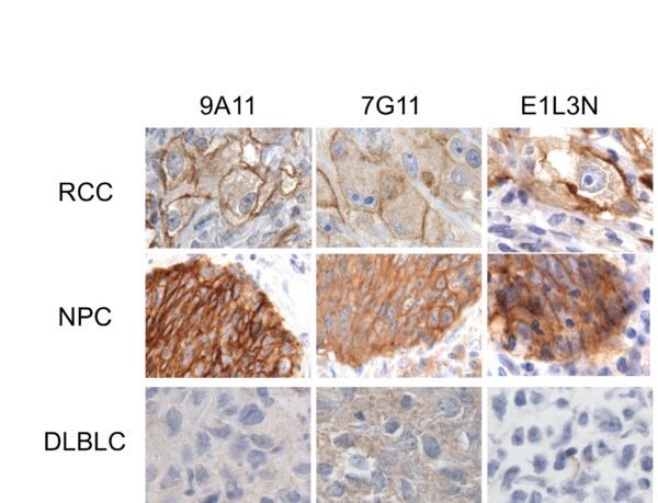 PD-L1/PDCD1-L1/CD274 [MD21R]