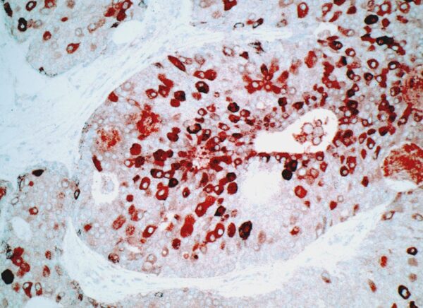 pS2 Estrogen Inducible Protein [GE2]