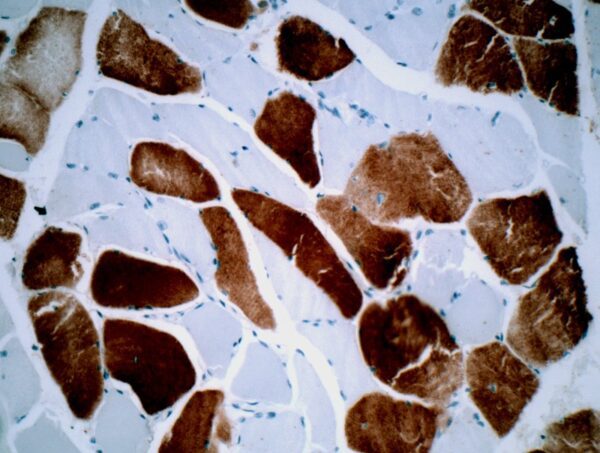 Respiratory Syncytial Virus (RSV) F Glycoprotein [5A6]