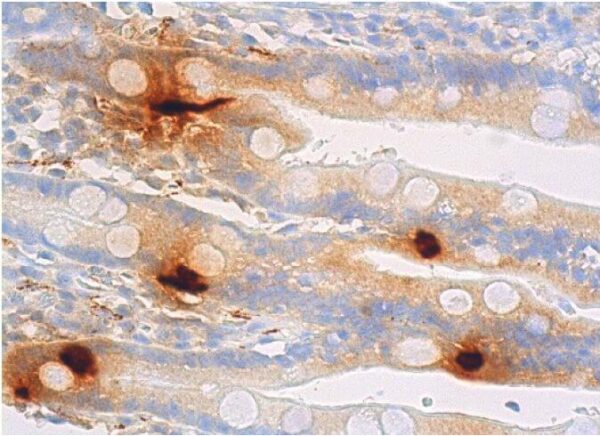 Somatostatin [H11]