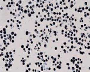H3K27Me3 [MD48R] RM0115_HepG2 cells